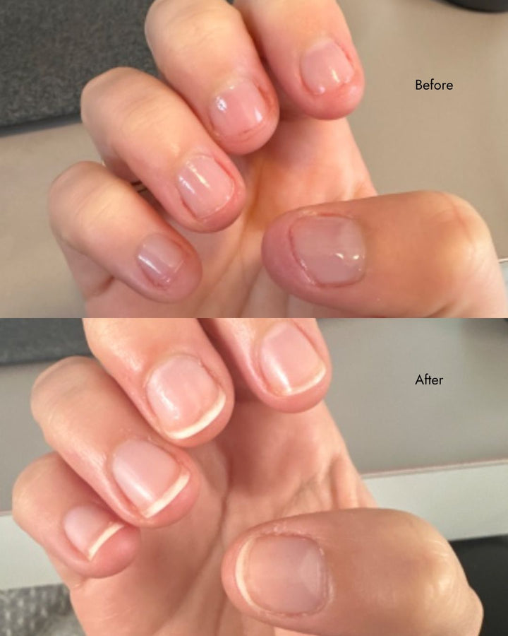 Before After Nail Strengthener